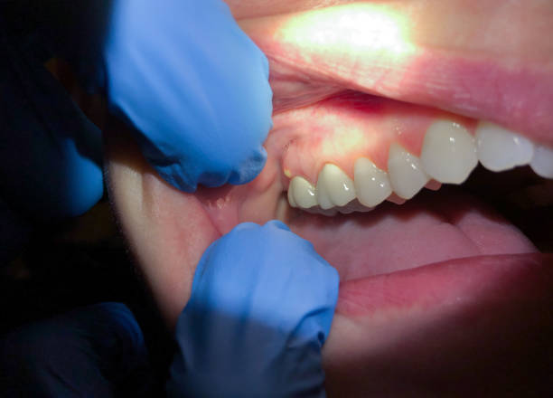 Best Emergency Dentist for Knocked-Out Tooth in Payson, UT