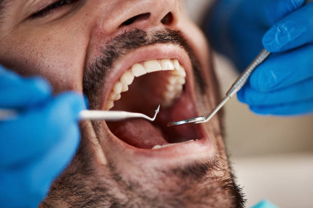 Best Emergency Dental Services for Seniors in Payson, UT
